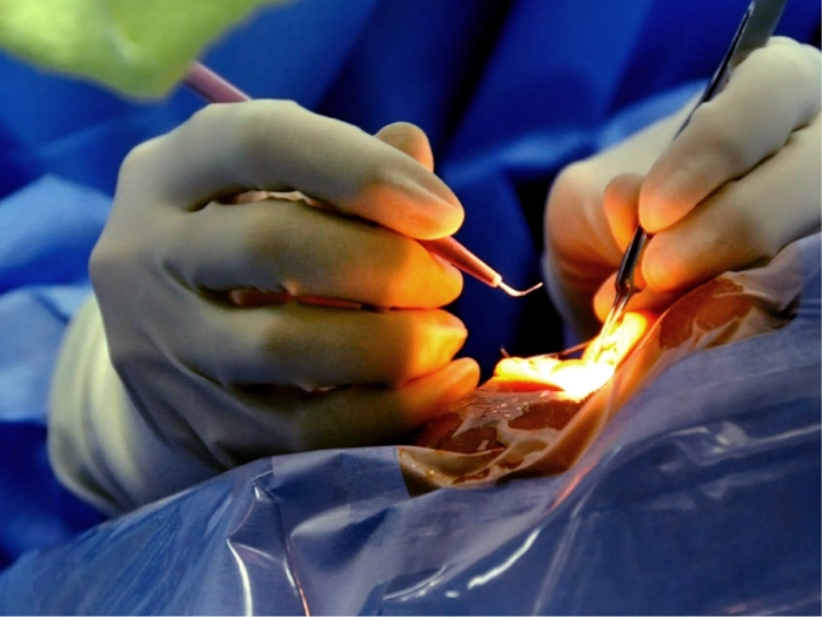 日帰り手術について