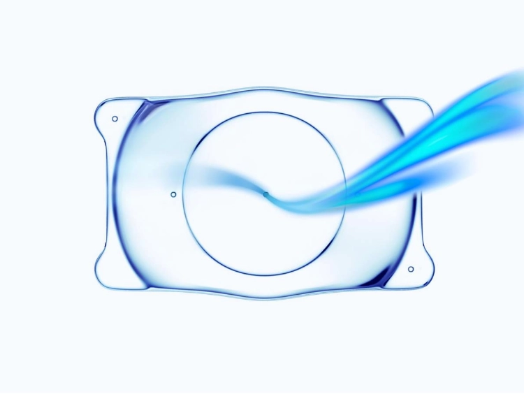 眼内コンタクトレンズ（ICL）