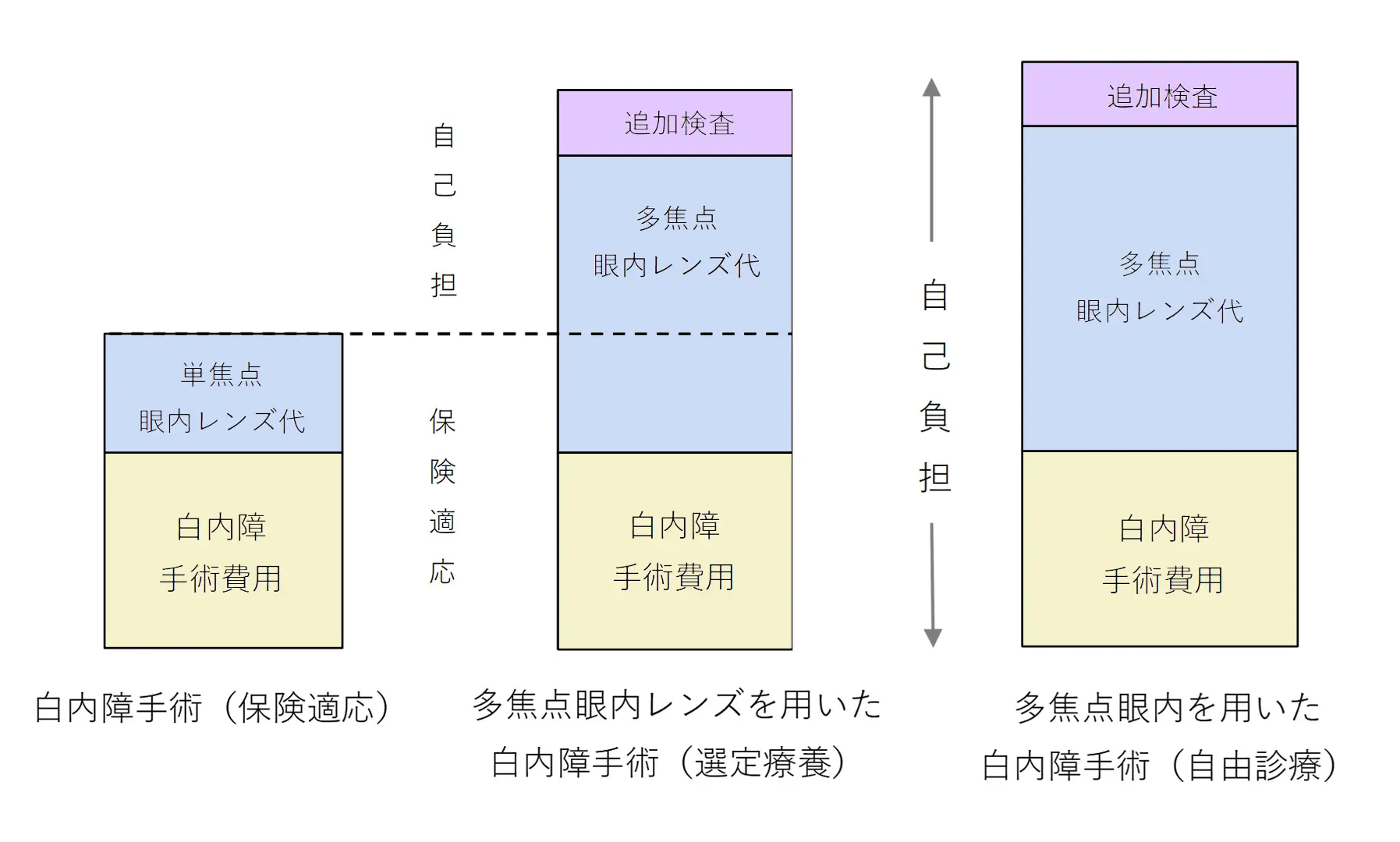 多焦点眼内レンズには「選定療養」のものと「⾃費診療」のものにわかれます。